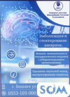 Лечим субарахноидальное кровоизлияние:  0553103000;0505103000